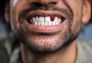Лекарство за възстановяване на зъби ще бъде тествано върху хора за първи път