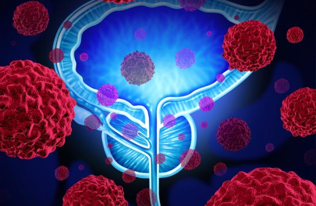 Изследване препоръчва мъжете да не прибързват с терапия за рак на простатата
